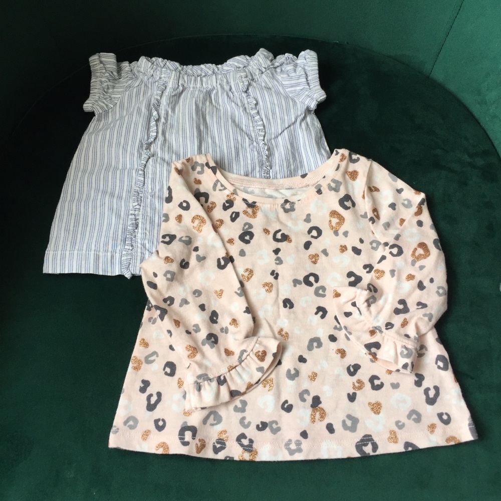 Baby Girl Top Bundle